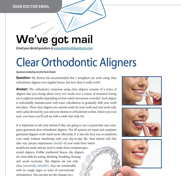 Clear Orthodontic Aligners