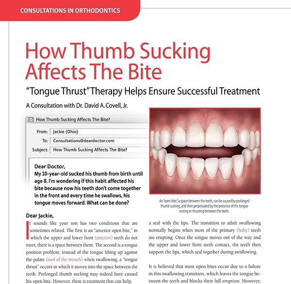 How Thumb Sucking Affects The Bite